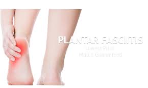 Plantar Fasciitis Podiatry