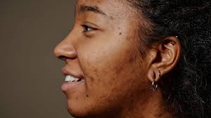 We're told we need to 'fix' our skin. What if we said no?