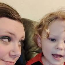 Poliosis (also called poliosis circumscripta), is the decrease or absence  of melanin (or colour) in head hair, eyebrows, eyelashes or any other hairy  area. Shout out to myself for apparently being super