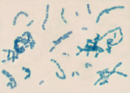 Image result for yersinia fotos