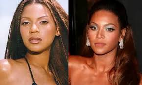 Black Actors In Their 30s 2020 10 Famous Celebrity Nose Jobs Before And After Pictures 2 Is Shocking In 2020 Nose Job Plastic Surgery Black Celebrities