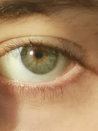 are these green or hazel eyes? : r/eyes