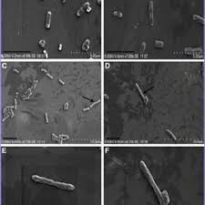 The two species of salmonella are salmonella enterica and salmonella bongori. Scanning Electron Microscope Images Of Salmonella Typhimurium Atcc Download Scientific Diagram