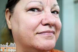 Maybe you would like to learn more about one of these? Dermawand Does It Work My 3 Week Trial Results