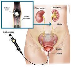 Pin On Kidney