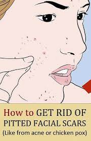 Pin On Beauty Tutorials