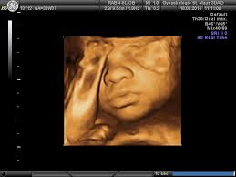 Ich weiß, je später desto größer und u.a. 3d Ultraschall Frauenarzt In Gummersbach Steffen Maus