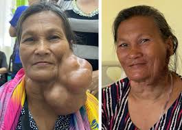 Valladolid, Philippines 2025