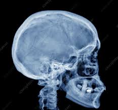 Image result for Skull XRay