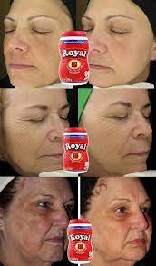 receita com po royal para clarear a pele passo a passo claradeovocomporoyalparaorosto comousarporo pomada para clarear axilas clarear pele manchas no rosto