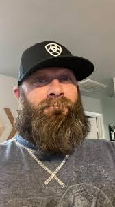 Hello all I am just over 2weeks since my first day of the problem. I can  only see shapes, no details with my right eye. I have an appointment this  Friday for