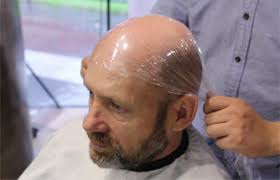 ALL French Lace Hair Replacement System