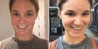 How To Get Rid Of Redness On Your Face After Working Out Self get rid of redness on your face after