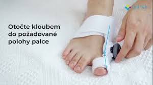 Image result for vybočený palec ortéza