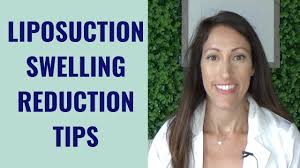 Liposuction Swelling Reductin Tips Liposuction Recovery Liposuction Tummy Tucks Recovery