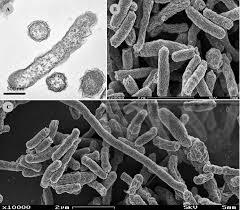 Image result for Sericanthe chimanimaniensis