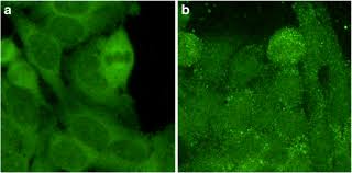 Image result for ANA Staining Pattern