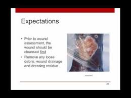 Woundrounds Webinar Wound Assessment Documentation A