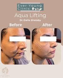 Ask Dr Hend Ibrahim..