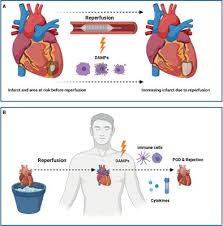 With only days left before the execution. Frontiers Damage Associated Molecular Patterns In Myocardial Infarction And Heart Transplantation The Road To Translational Success Immunology