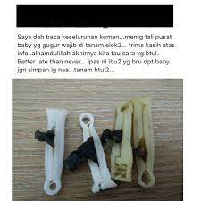 Tali pusat (terkadang juga disebut tali pusar) adalah jaringan pengikat yang menghubungkan plasenta dan fetus (janin). Ramai Mak Ayah Yang Simpan Tali Pusat Anak Kan Ustaz Azhar Idrus Jelaskan Hukumnya Pa Ma