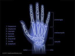 Hand X Ray - Medical Art Library