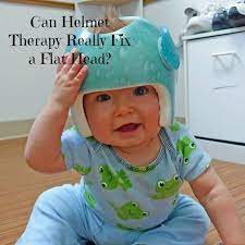 Cranial Helmet Therapy For Babies Can It Really Fix A Flat Head Baby Helmet Flat Head Baby Baby Pooping