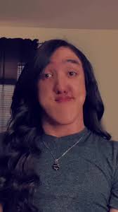 Guy with No Chin or Jaw