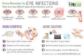 Home Remedies For Eye Infections Top 10 Home Remedies Natural Headache Remedies Stuffy Nose Remedy Allergy Remedies