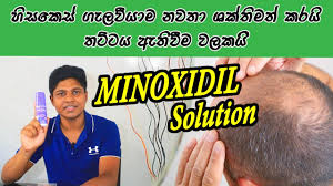 Treatment For Hair Loss Minoxidil Sinhala Medical Channel Youtube
