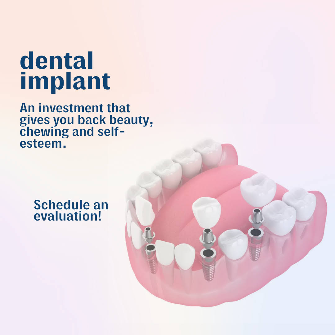 DENTAL IMPLANTS product image