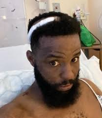 GoFundMe launched after Frank has plate fitted in his skull