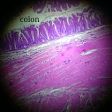 The sigmoid colon is the continuation of the descending colon linking the descending colon to the rectum. Colon Sigmoideum Doccheck Flexikon