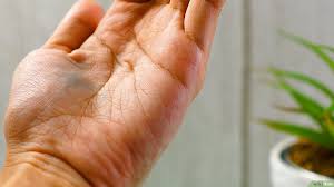 إزالة ألوان الطعام من جلدك Wikihow