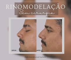 Maria Aires (@mariaairesmedspa) • Instagram photos and videos