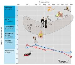 degrees of hearing loss hearing health foundation