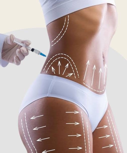 Body lipolysis – Esteetiline meditsiin | Laser- ja aparaatne kosmetoloogia  – Melior