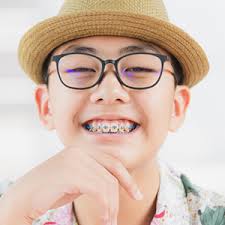 If you prefer symmetry with the left, then use botulinum toxin ( i.e., dysport) on the right. Orthodontics More Than Straightening A Crooked Smile