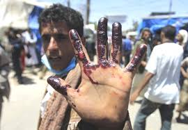 Image result for YEMEN WAR PHOTOS