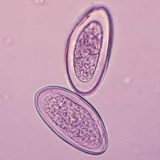 We did not find results for: Oxyuris Vermicularis Cacing Kremi Indonesian Medical Laboratory