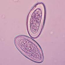 Another putative pinworm species, enterobius gregorii, has been described and reported from. Oxyuris Vermicularis Cacing Kremi Indonesian Medical Laboratory