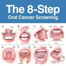 Dentalelle Tutoring Welcome Blog Dental Hygiene School Dental Anatomy Oral Cancer