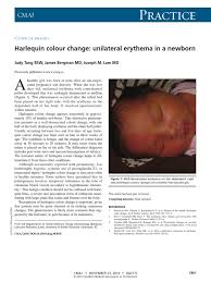 Image result for Harlequin Color Change