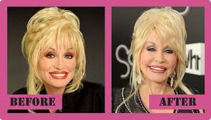 There may be a reason why dolly parton always wears long sleeves. Dolly Parton Plastic Surgery Procedures That Changed Her Looks