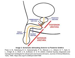 Image result for Genitourinary Trauma