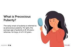 Image result for Precocious Puberty
