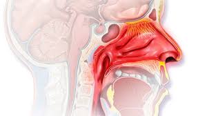 In these cases the medicine is absorbed into the bloodstream from the lining of the nose, which is rich in blood vessels. Headache And Nosebleed Causes Photos And Treatments
