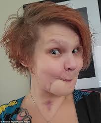 EXCLUSIVE: I shot myself in the face TWICE and miraculously survived... I  will forever regret it but now I'm using my pain to bring hope to others