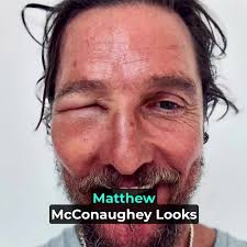 Matthew Mcconaughey Speedo Photo