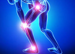 Bilde Resultater for Fibromyalgi Smerter i underkroppen (ben, knær og hofter)